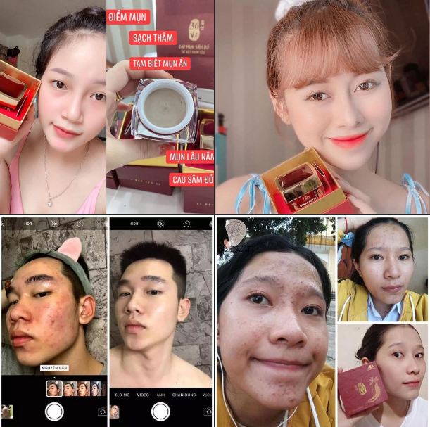 Công dụng của Cao Mụn Sâm Đỏ
