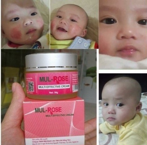 Công dụng của kem Mul Rose