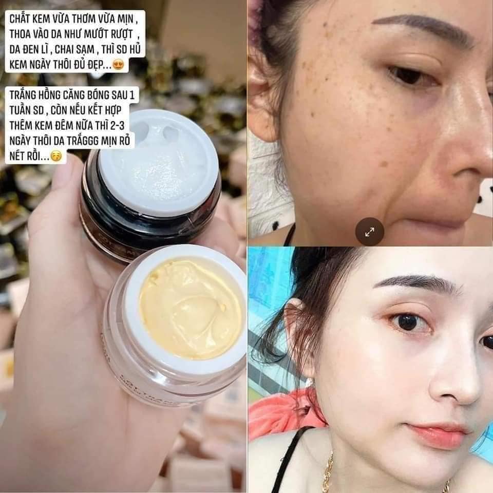 Trọn bộ combo Nicos dưỡng trắng da trị nám