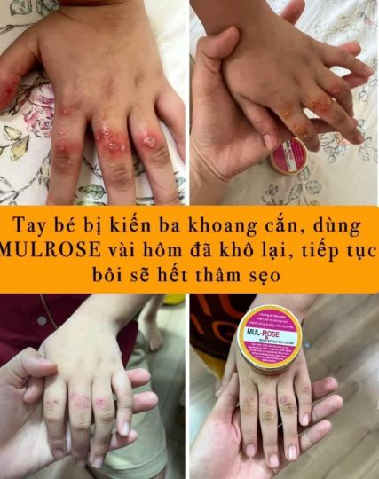 Kem Mul Rose chính hãng