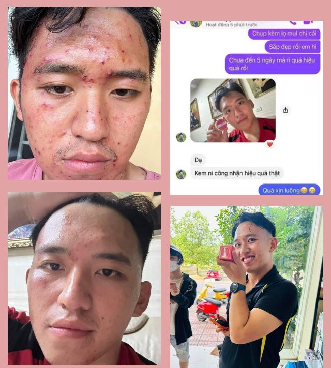 Review Kem Mul Rose từ khách hàng