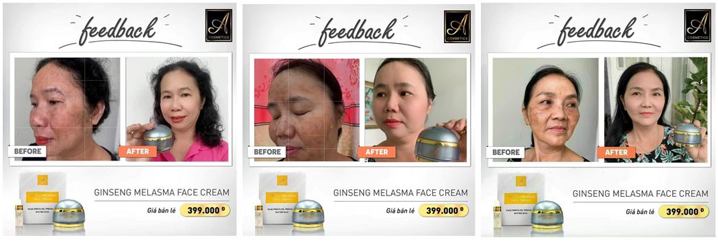 Review của khách hàng sau khi sử dụng kem Face nám nhân sâm Acosmetics