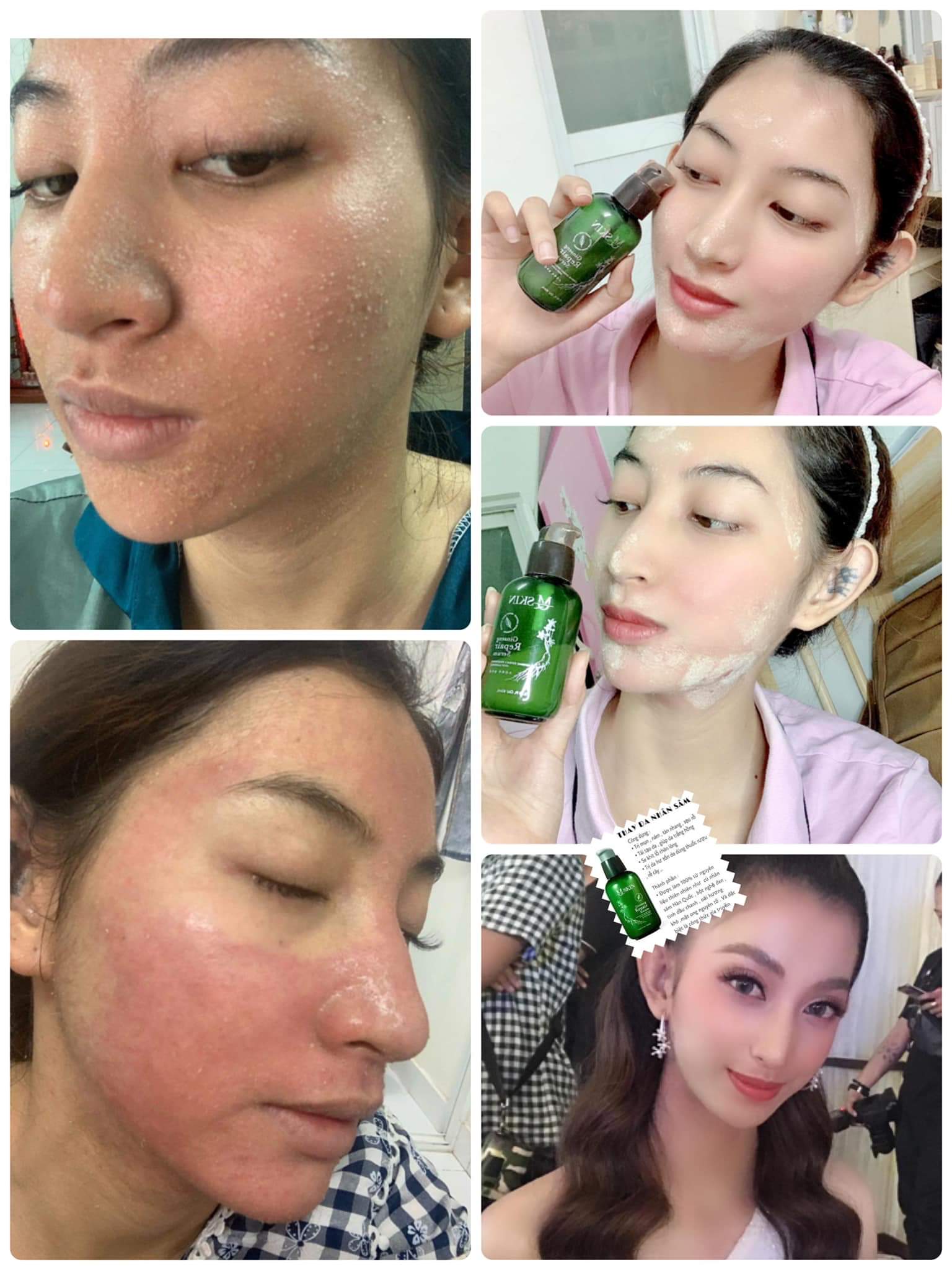 Review của khách hàng sau khi dùng Serum Mq Skin