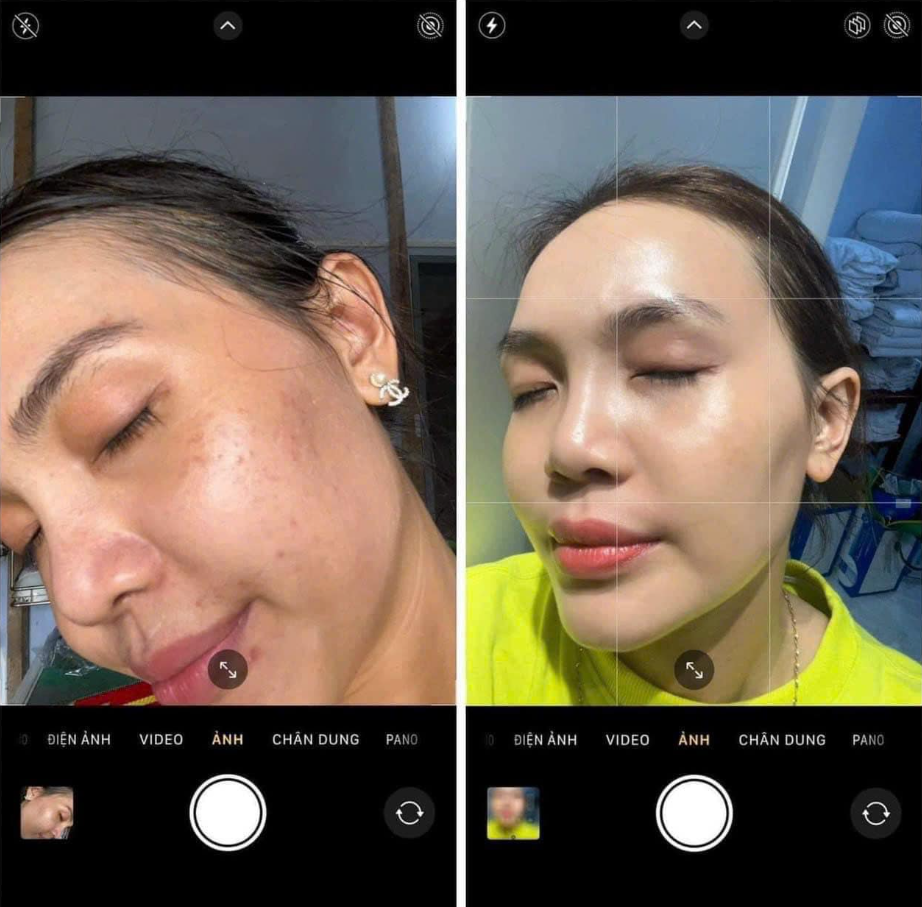 Kem dưỡng trắng da trị mụn hiệu quả