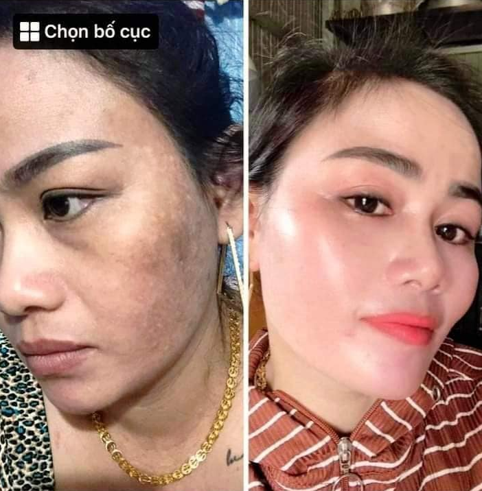 Kem Hàn Quốc Demejine dưỡng da hiệu quả