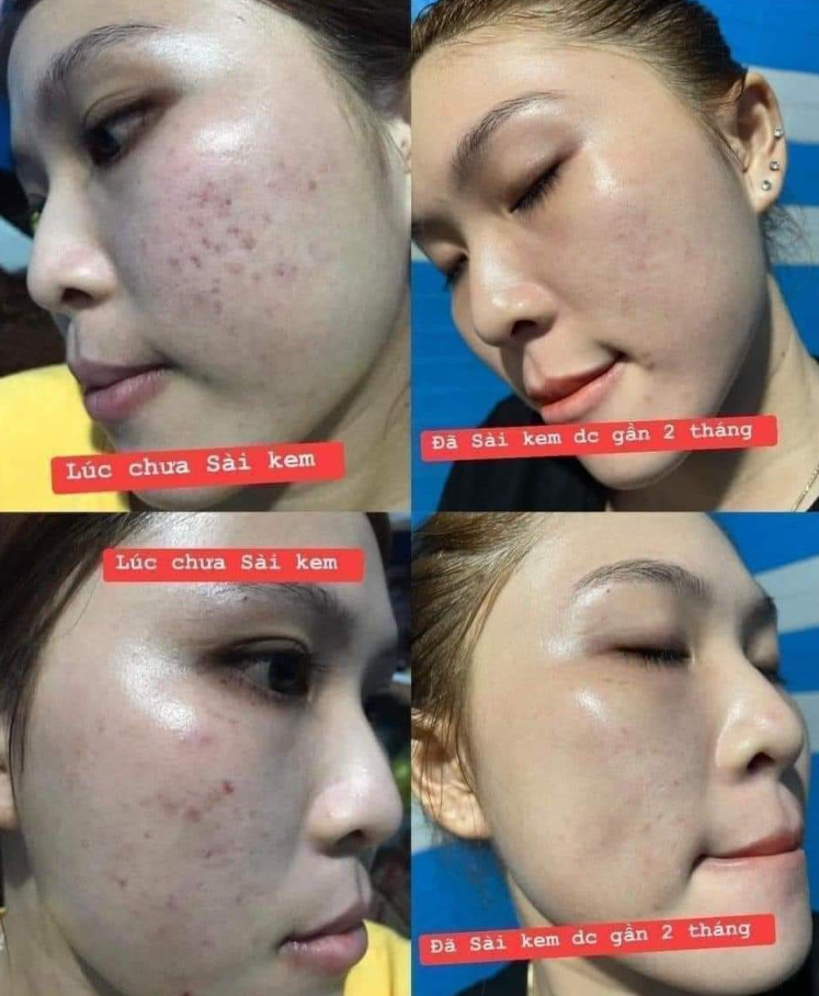 Review từ khách hàng sau khi dùng sản phẩm Demejine