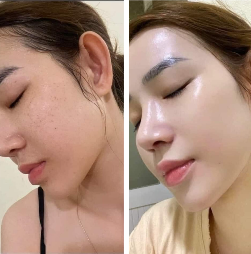 Sử dụng kem ngày và đêm như thế nào để đạt hiệu quả