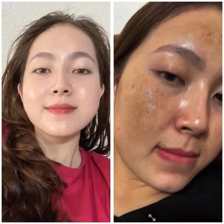 Review collagen plus vit E có tốt không