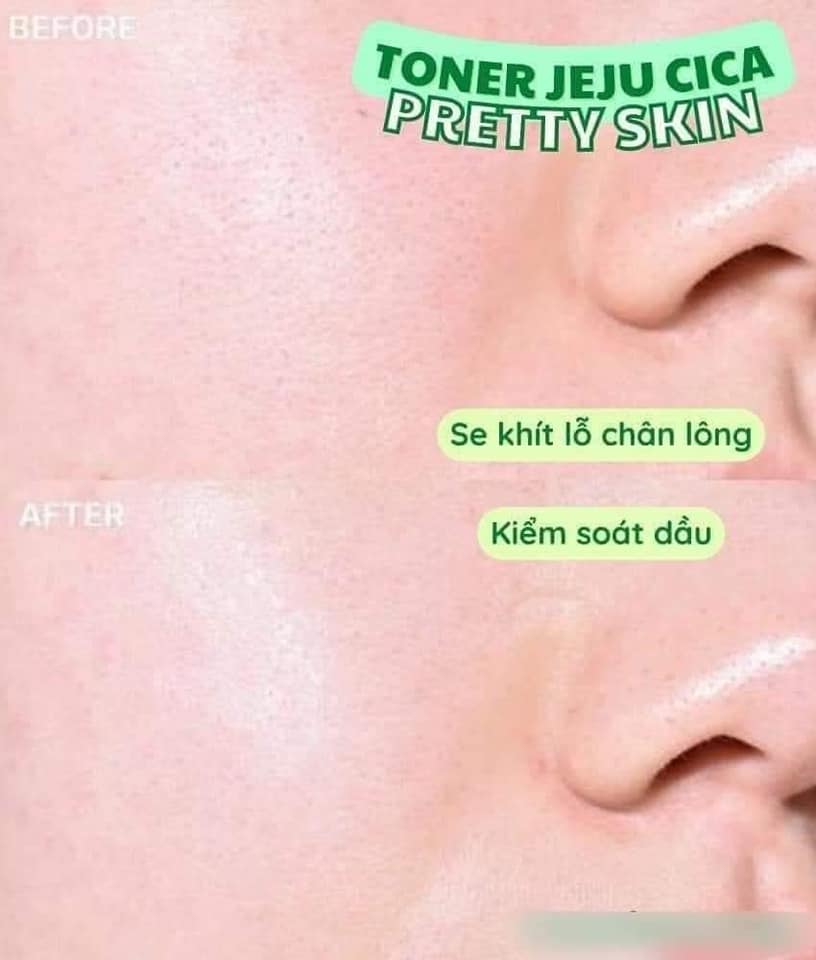 Review nước hoa hồng rau má Pretty Skin