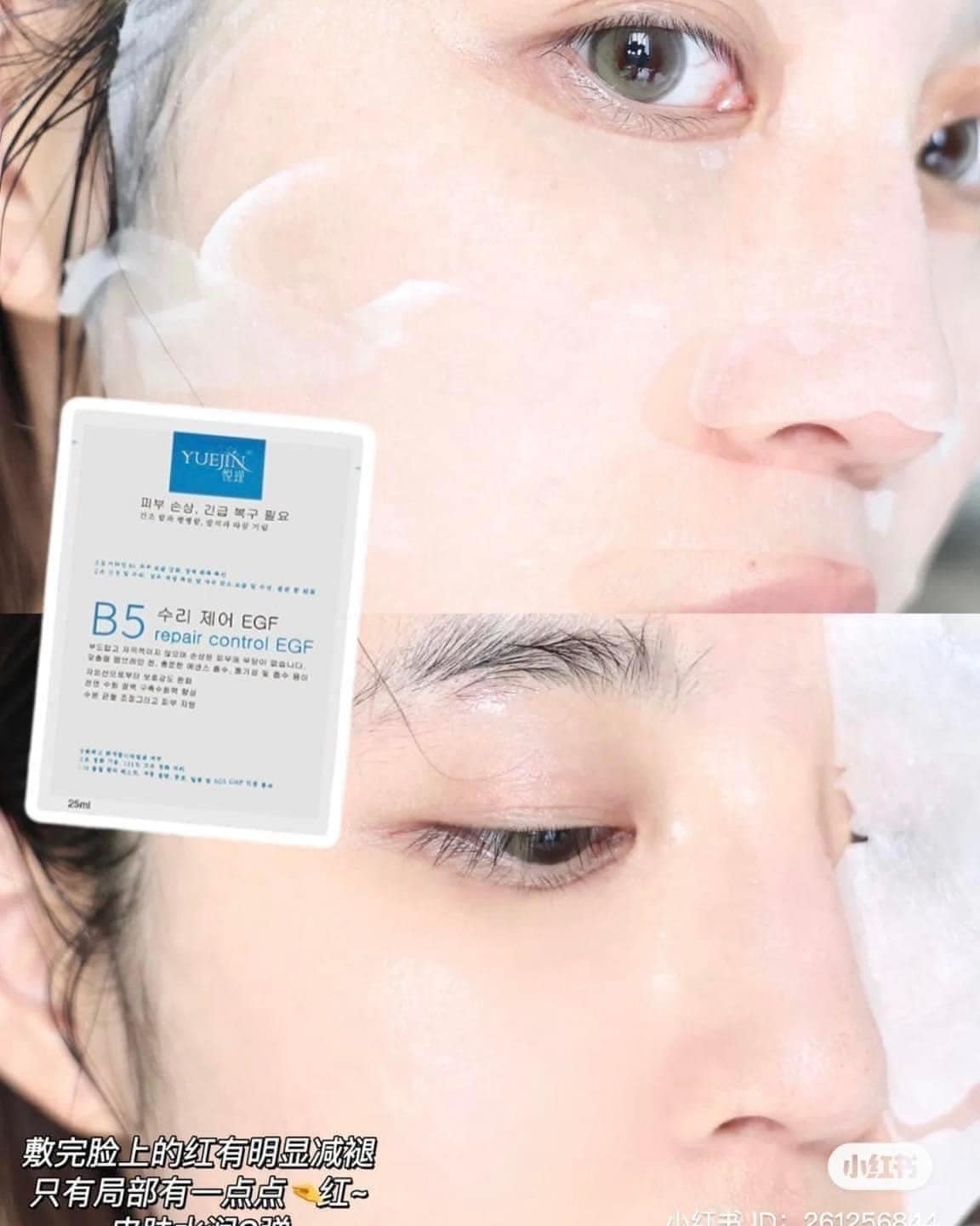 Mặt nạ Yuejin B5 có tốt không