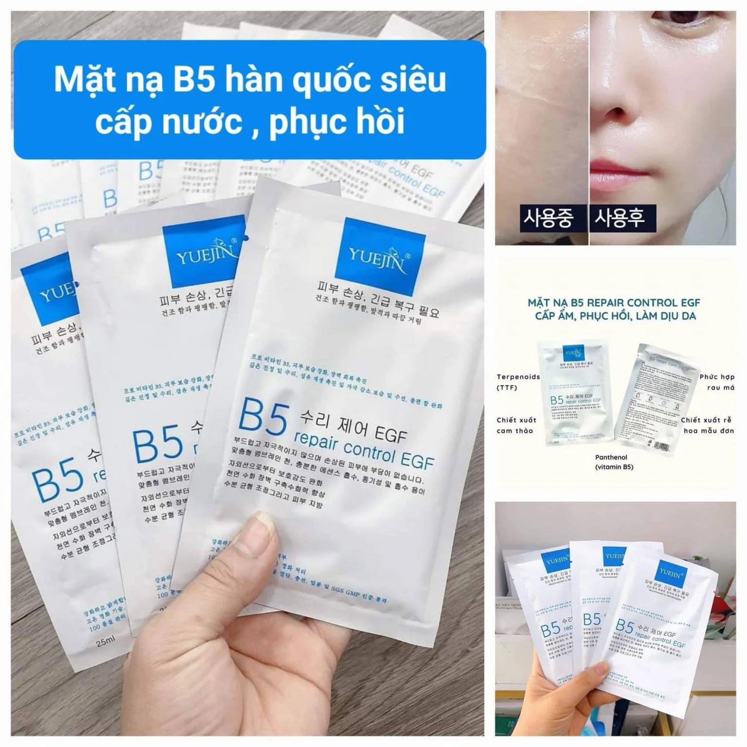 Mặt nạ Yuejin B5 Repair Control EGF nhận được rất nhiều những phản hồi tích cực