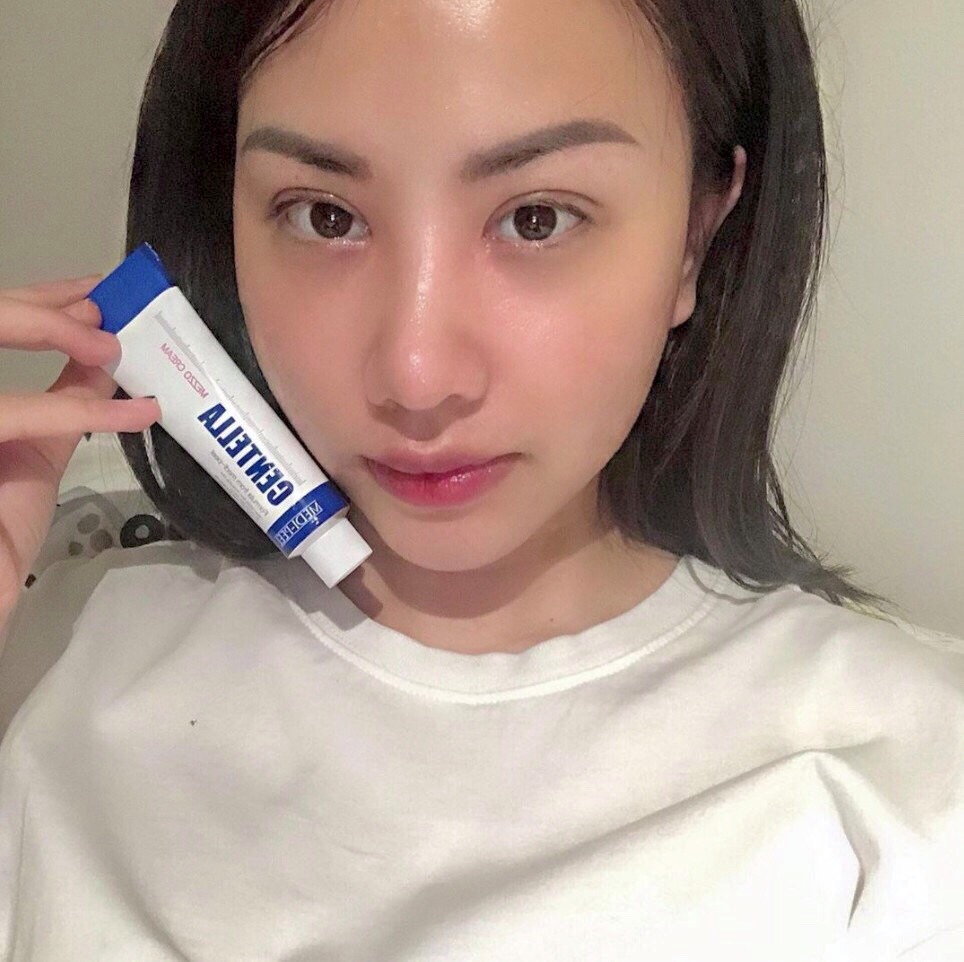 Review kem trị mụn Centella từ khách hàng