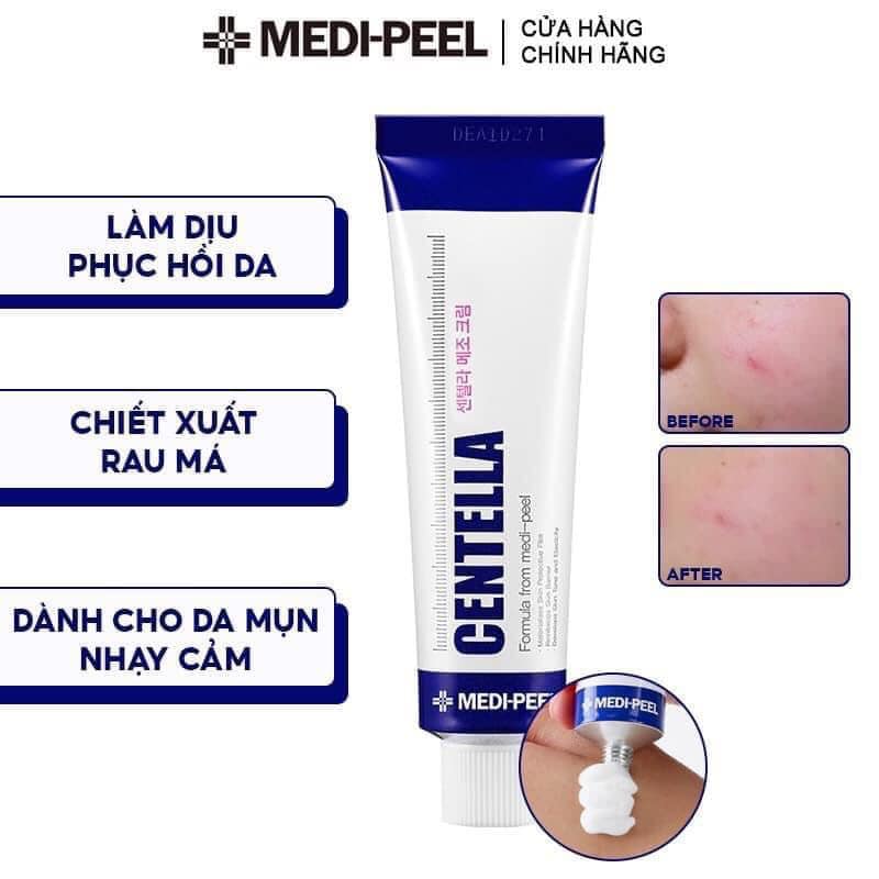 Kem trị mụn Hàn Quốc Centella