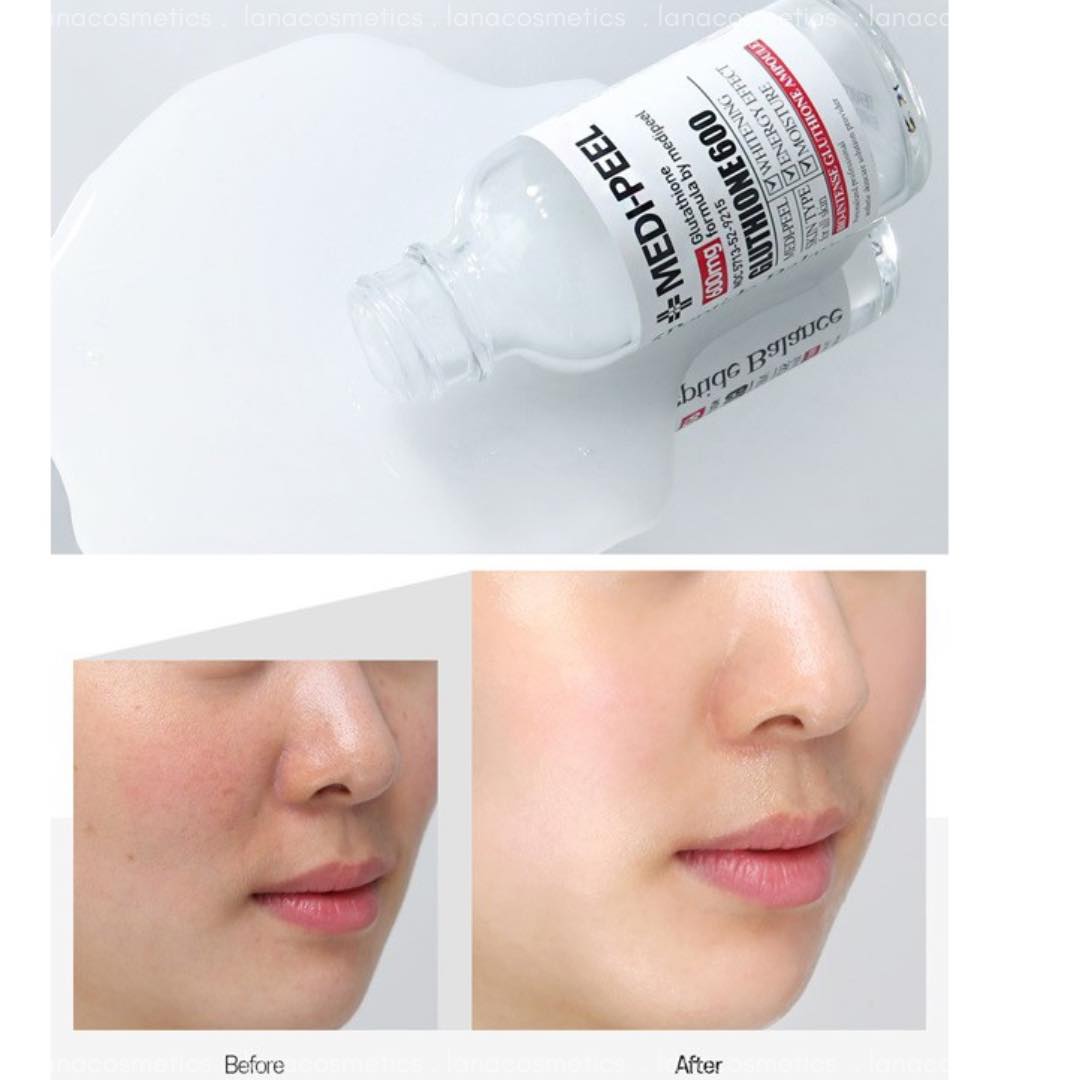 Công dụng Tinh chất trắng da Medi-Peel Glutathione 30ml