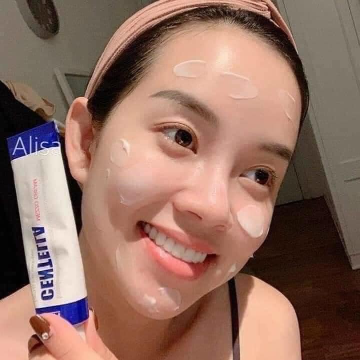 Review trị mụn Centella từ khách hàng