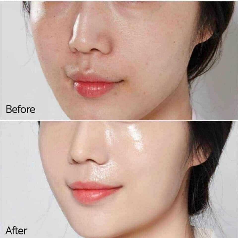 Tác dụng Retinol X5 Elastin Cream Skinpastel mang lại