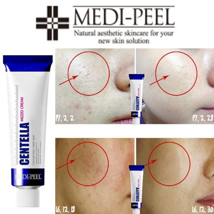 Kem dưỡng Centella Medi Peel