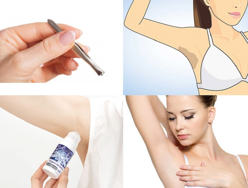 Nguyên nhân khiến nách bị thâm, tối màu