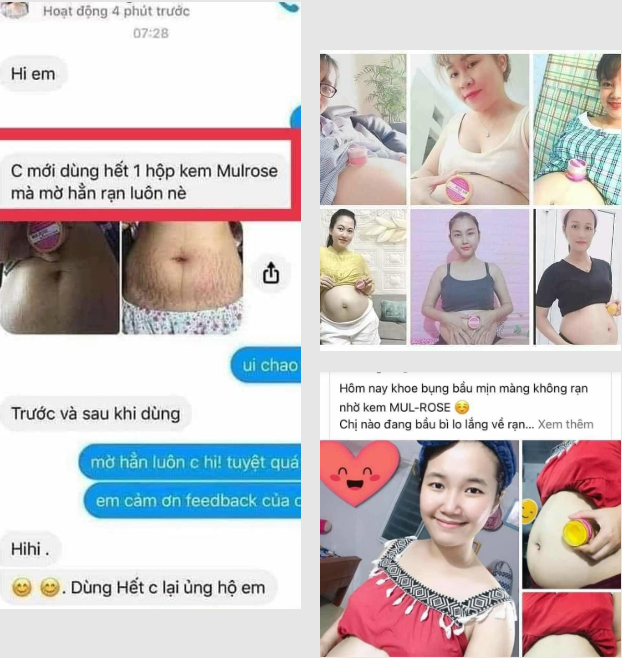 Khách khoe bụng bầu mịn màng ko rạn nhờ kem MUL-ROSE