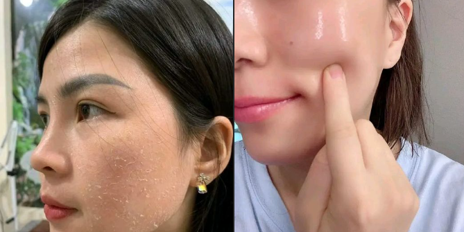 Công dụng Serum Yody White