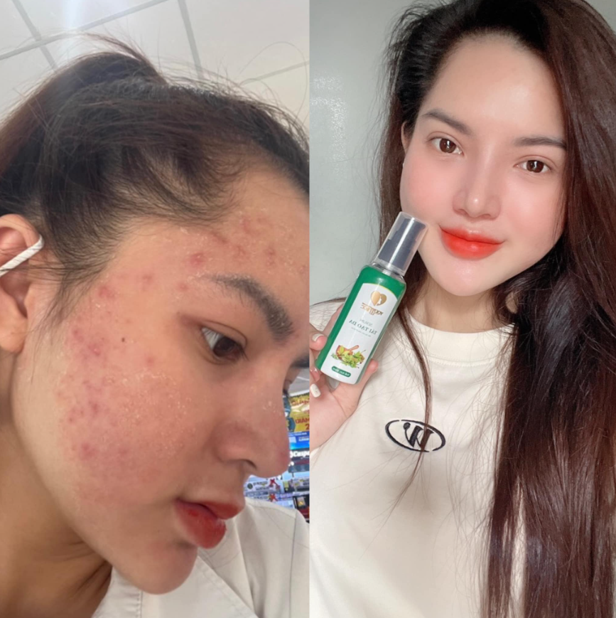 Hình ảnh khách hàng sau khi sử dụng Yody White Phương Anh