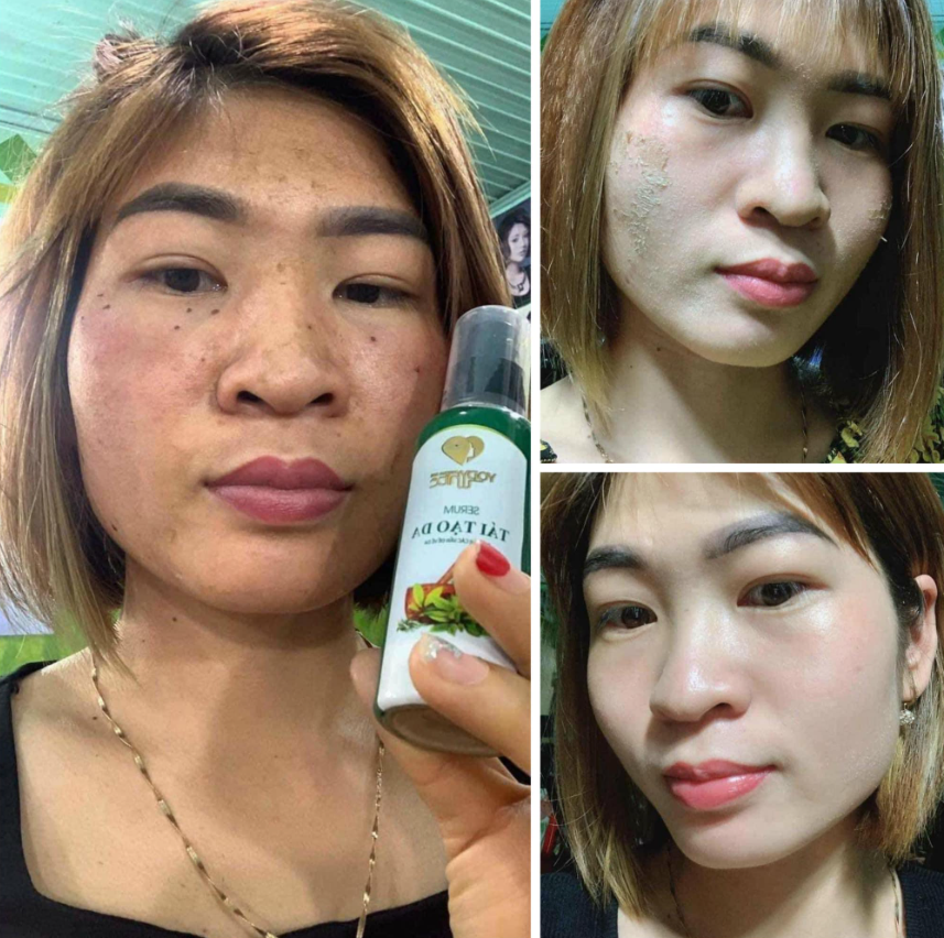 Hình ảnh khách hàng sau khi sử dụng Yody White Phương Anh