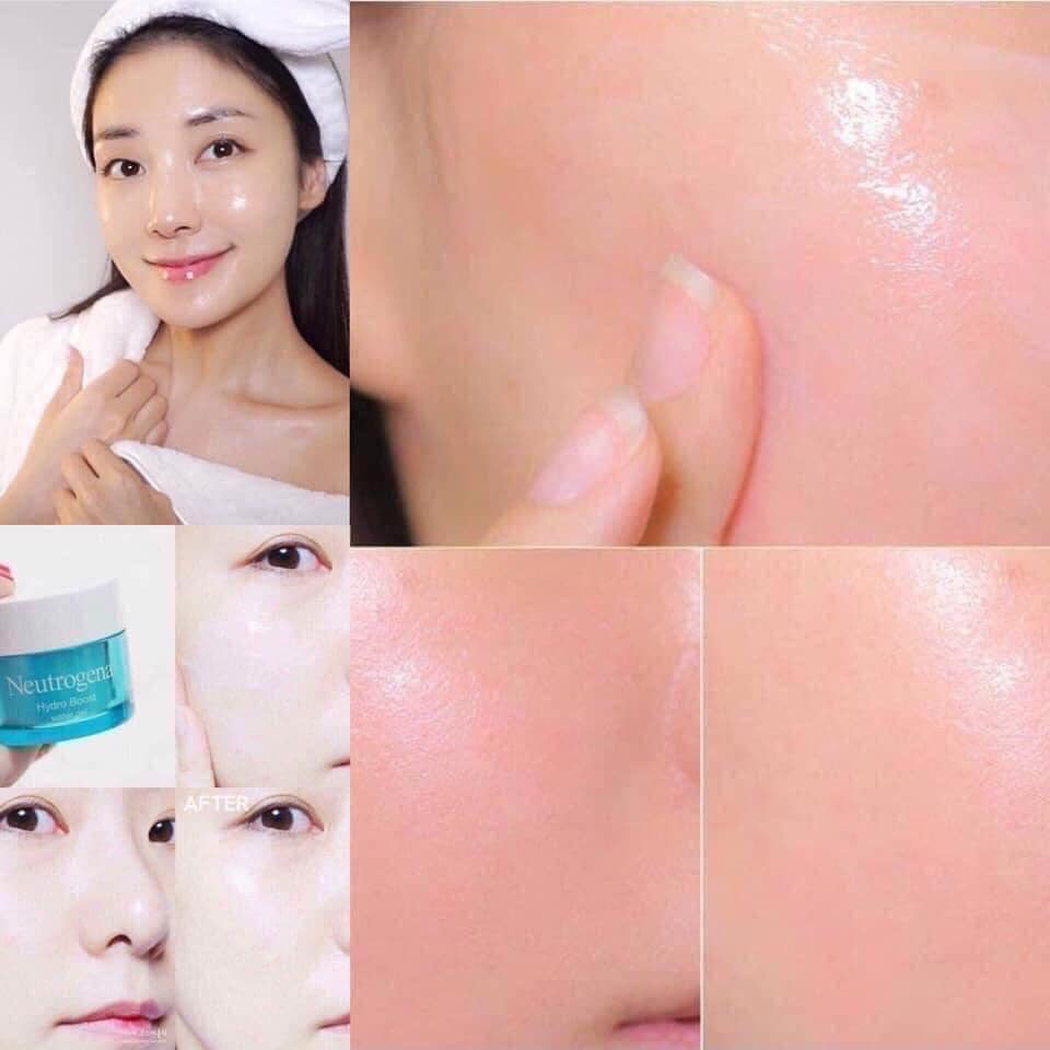 Review thực tế Neutrogena Hydro Boost Gel-Cream