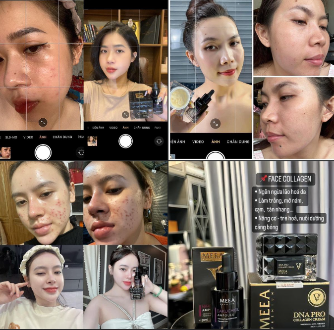 Hình ảnh khách hàng sau khi sử dụng sản phẩm