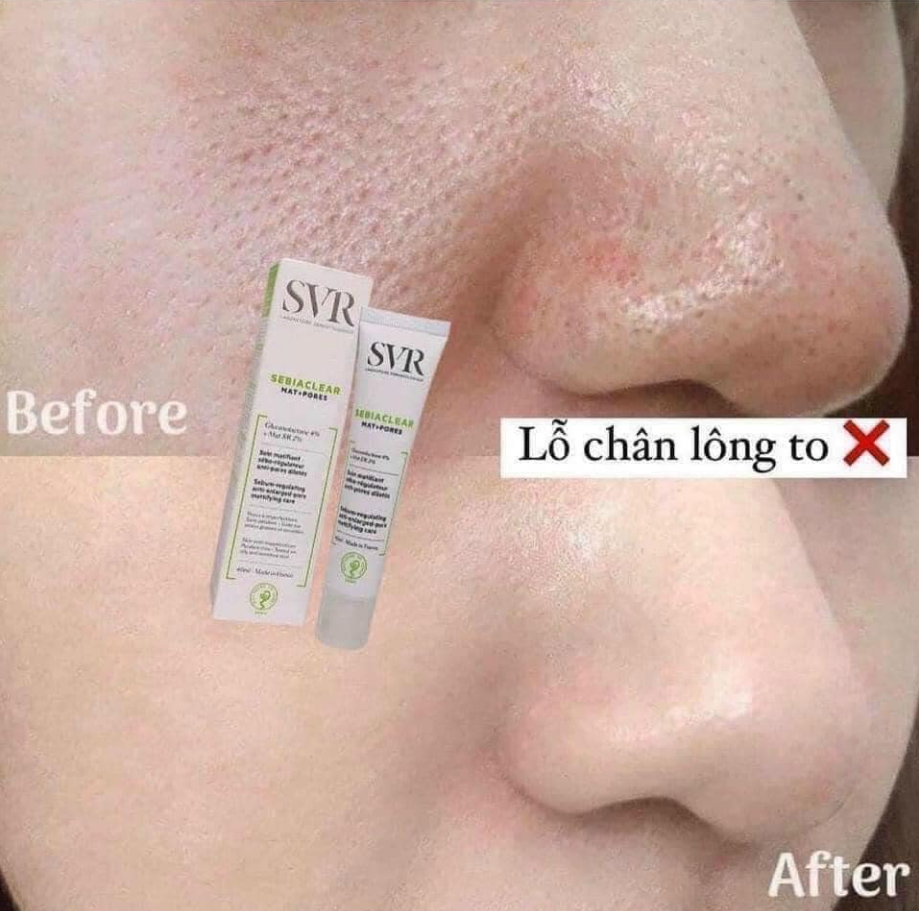 Bảo vệ da khỏi tác động của tia tử ngoại