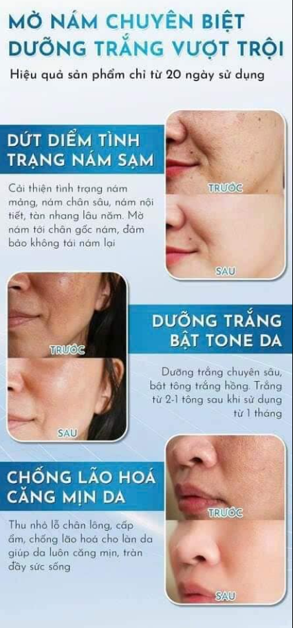 Kem Dakami trị nám hiệu quả