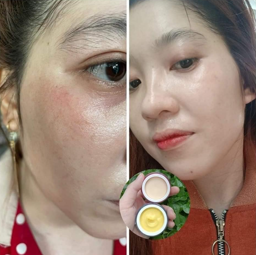 Hình ảnh khách hàng sau khi sử dụng sản phẩm