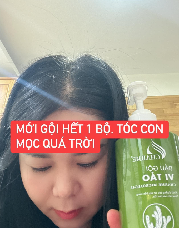 Combo Dầu Gội Vi Tảo là một lựa chọn mới đầy hứa hẹn cho việc chăm sóc tóc