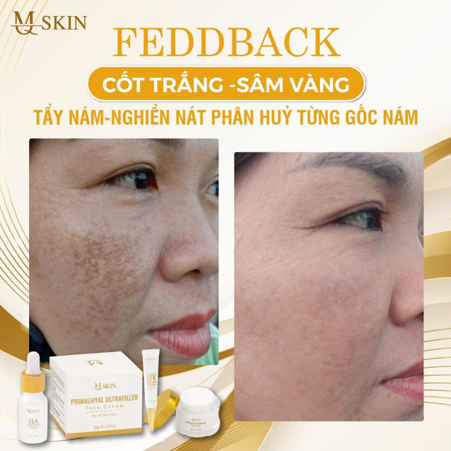 Review Combo Sâm Vàng Mq Skin từ người dùng