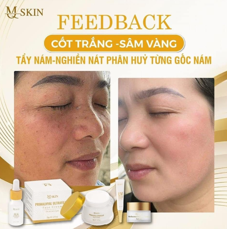 Review Kem Sâm Vàng Mq Skin từ người dùng