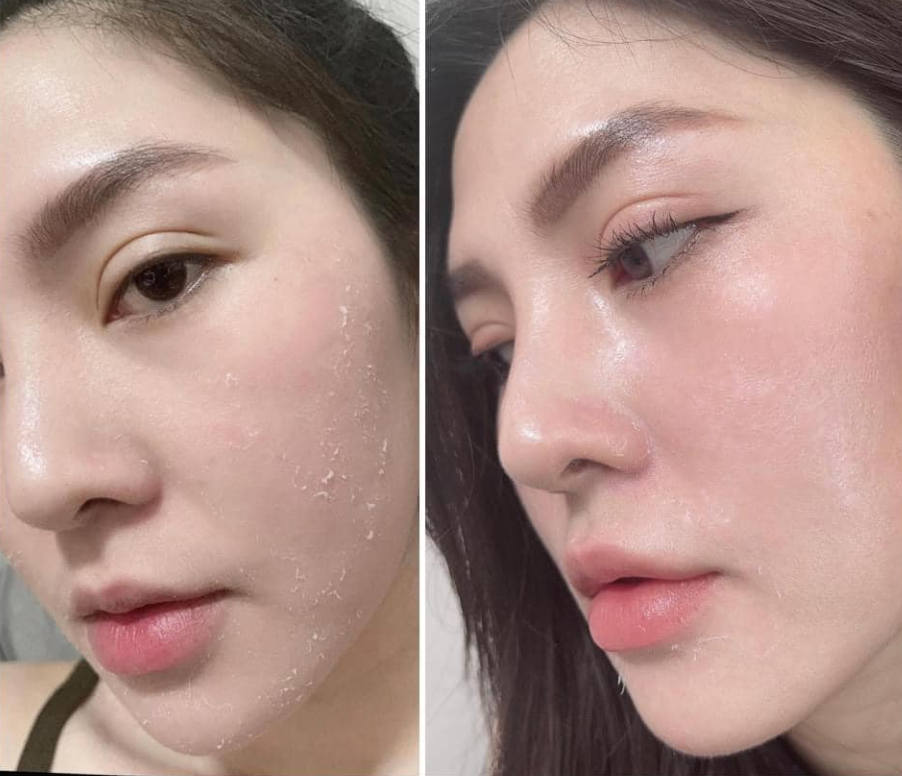 erum thảo dược tái tạo da Yody White