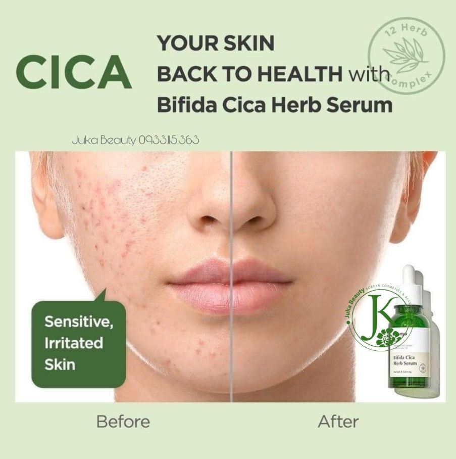 Serum Manyo Bifida Cica Herb có tốt không