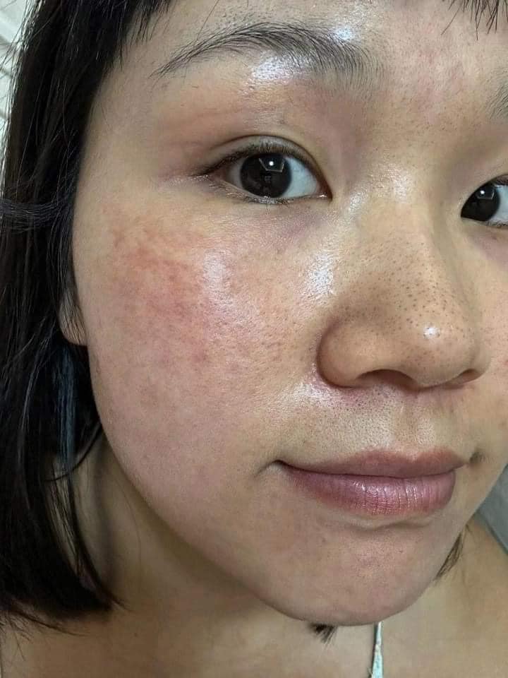 Sữa Dưỡng Las Beauty Rong Nho là sản phẩm dưỡng da cao cấp, phù hợp với nhiều đối tượng khác nhau