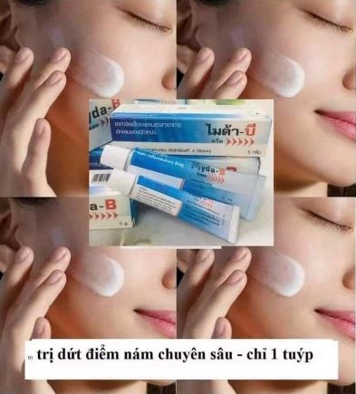 Thành phần của sản phẩm Kem trị nám Myda B Thái Lan