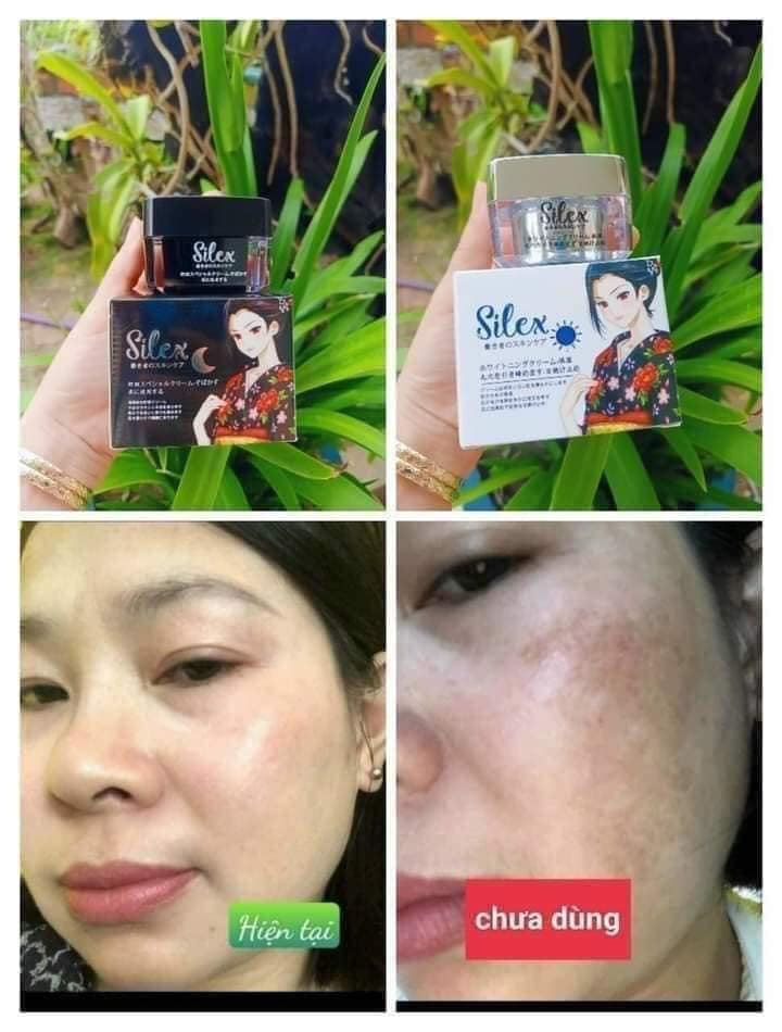 Kem Silex trị nám là sản phẩm kết hợp hoàn hảo các tinh chất làm trắng, chống nắng và dưỡng da tự nhiên