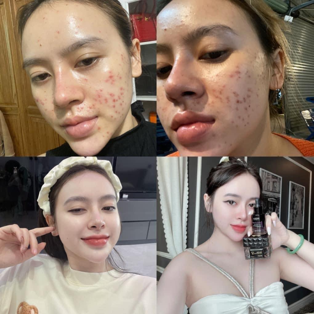 Dùng cho những người muốn chăm sóc da trắng mịn, mềm mại