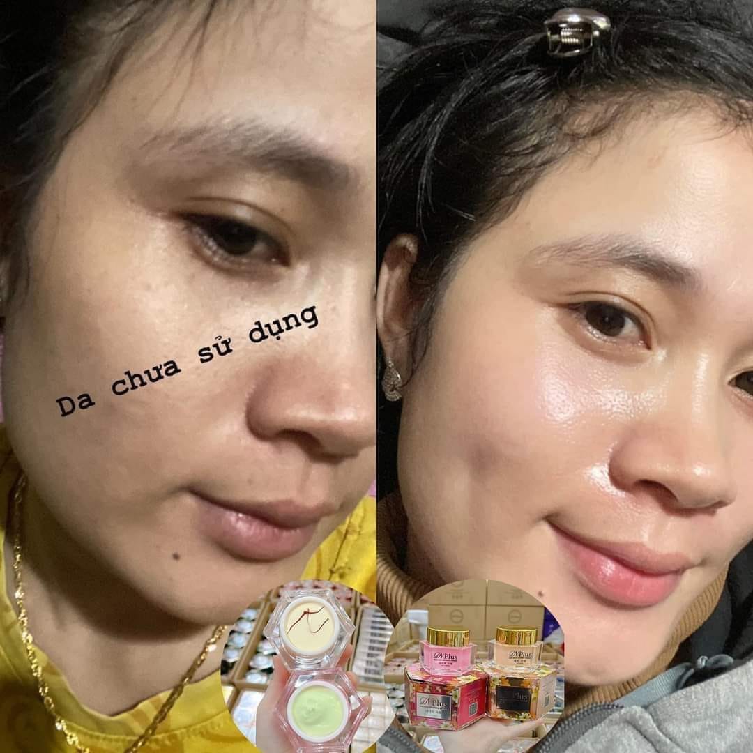 Một số đánh giá review Combo Demejine Plus từ khách hàng