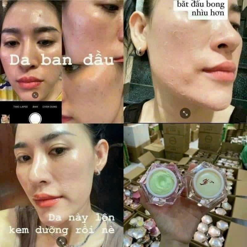 Combo Tái Tạo Demejine Plus Có Tốt Không