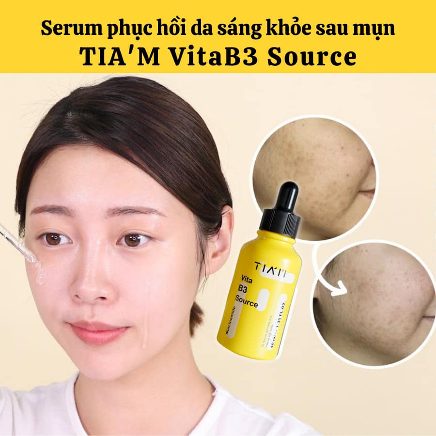 Một số đánh giá review từ khách hàng về serum TIAM vàng