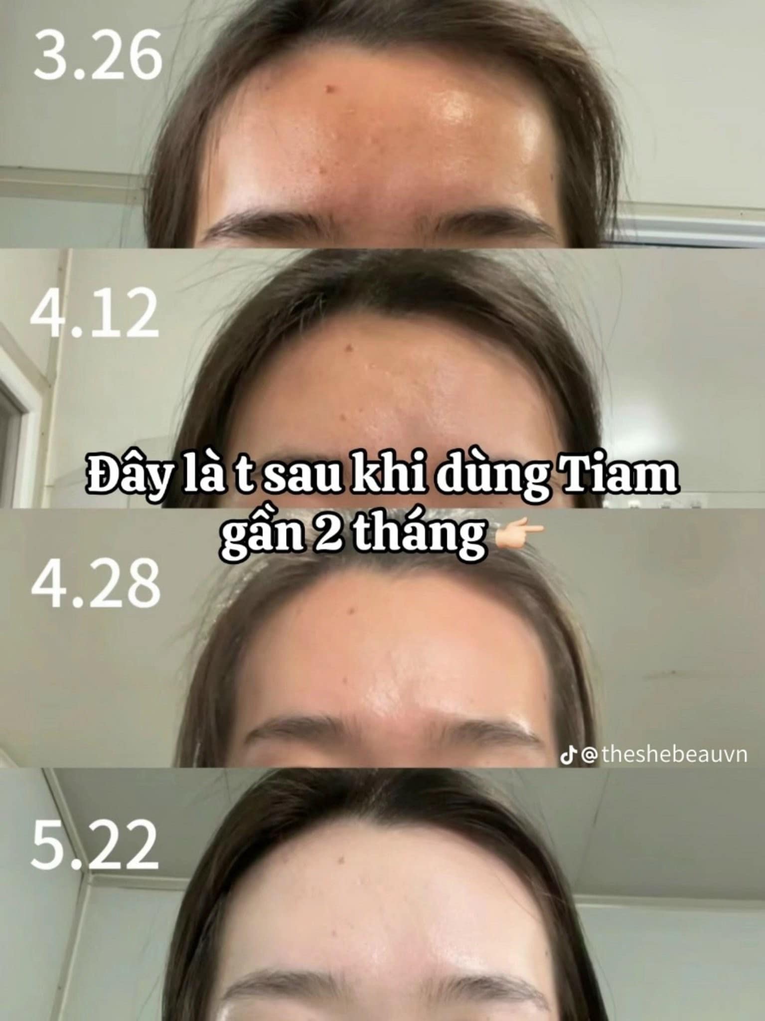 Hiệu quả sau khi sử dụng serum Tiam sau 2 tháng