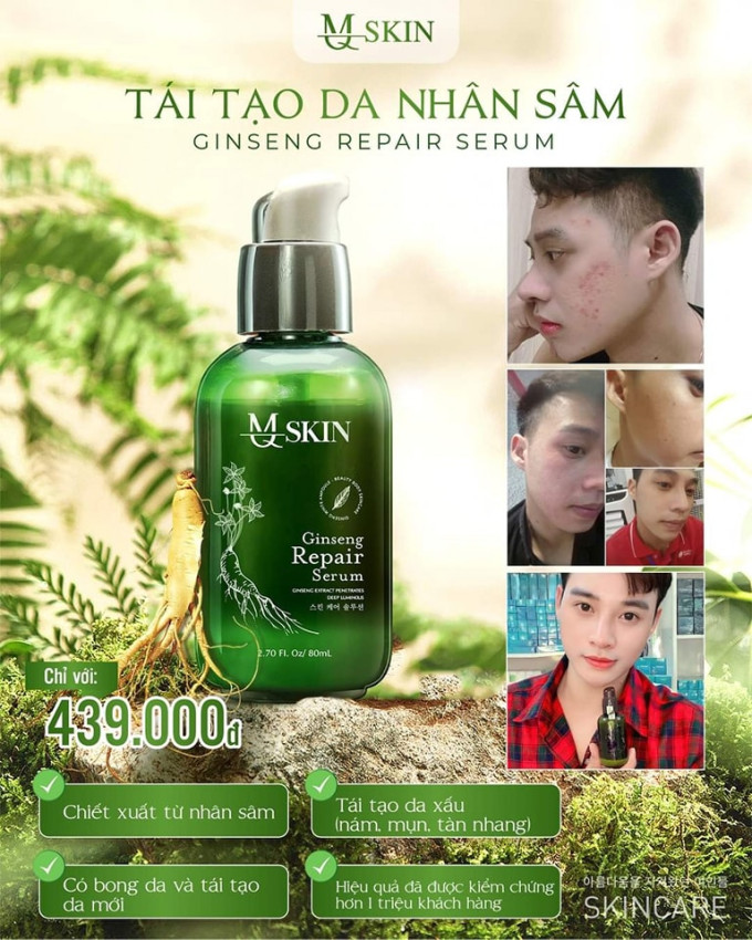Serum Thay Da Nhân Sâm MQ Skin có tốt không?