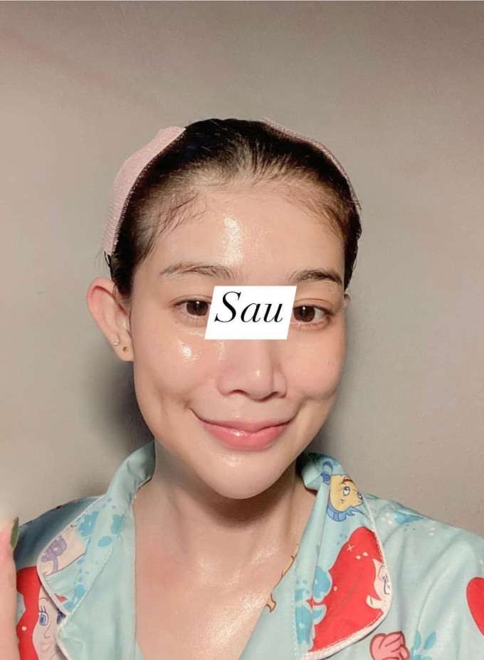 Cơ chế tác dụng của Serum thay da nhân sâm MQ Skin