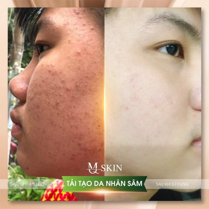 Review Serum MQ Skin Tái Tạo Da chính hãng