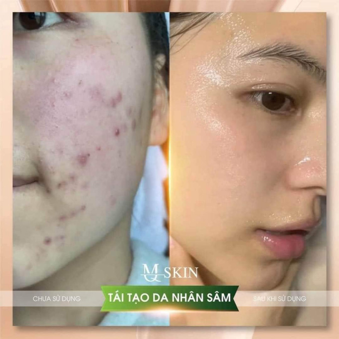 Review Serum thay da nhân sâm MQ Skin chính hãng