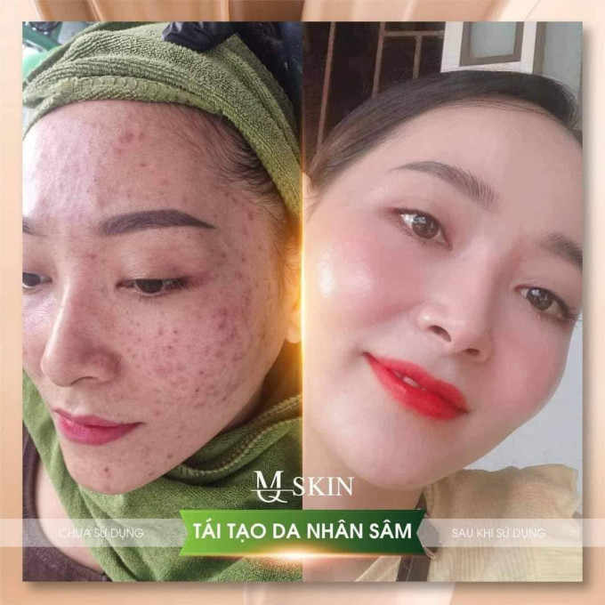 Công dụng Serum MQ Skin Tái Tạo Da