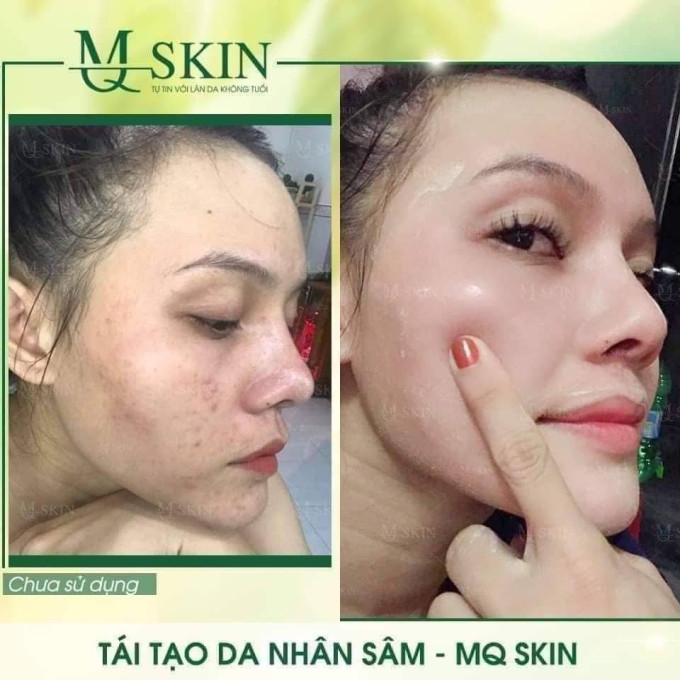 Nhiều khách hàng sử dụng Mq Skin thay da có hiệu quả